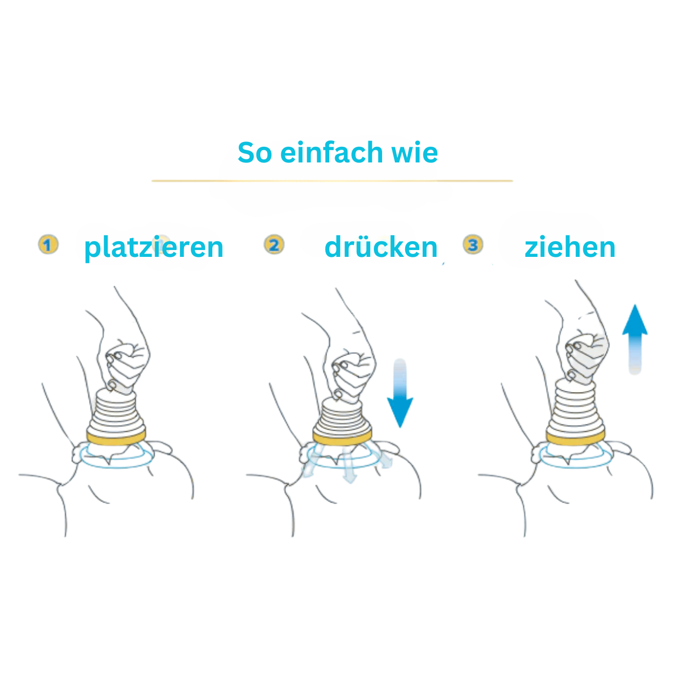 Anti-Erstickungsgerät